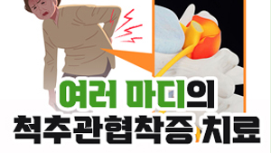 여러 마디 척추관협착증 치료에 효과적인 수술
